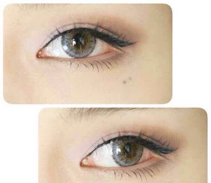 势赢交易7月23日热点品种技术分析【MK电竞】(图3) MK电竞